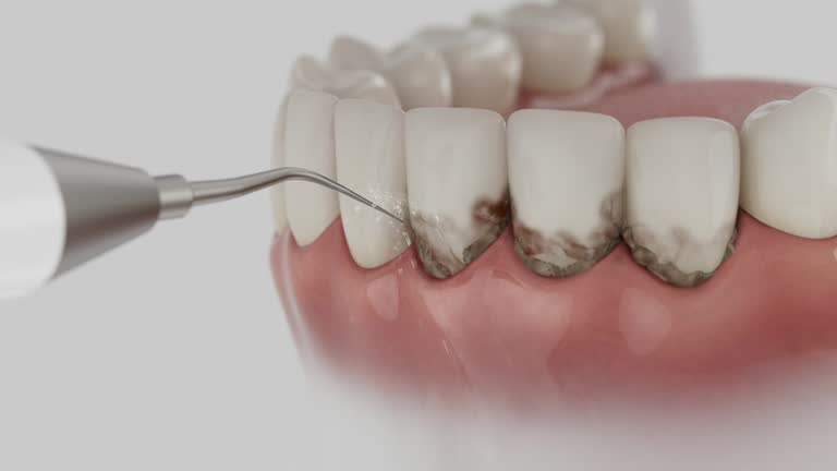 Reliable Dental contractor in Fort Shawnee, OH by Dentist Open Now
